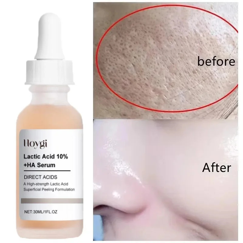 Acido lattico Ridurre i pori S - Licorice Root Extract recensione e prezzo