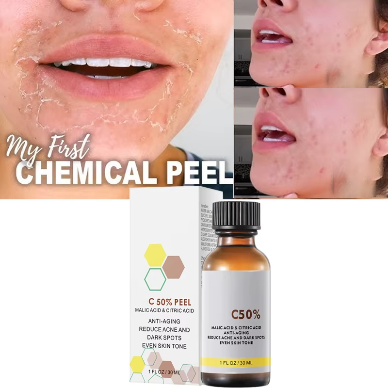 Con acido malico e acido citri - Licorice Root Extract recensione e prezzo