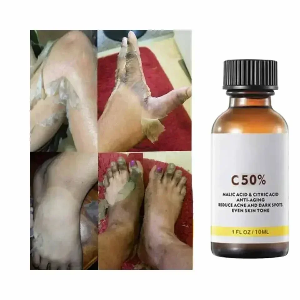 Con acido malico e acido citri - Licorice Root Extract recensione e prezzo